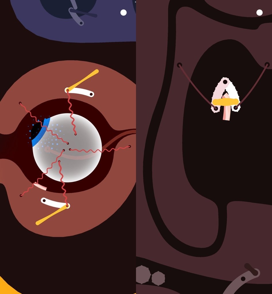 Bacon in Zane 220426 02